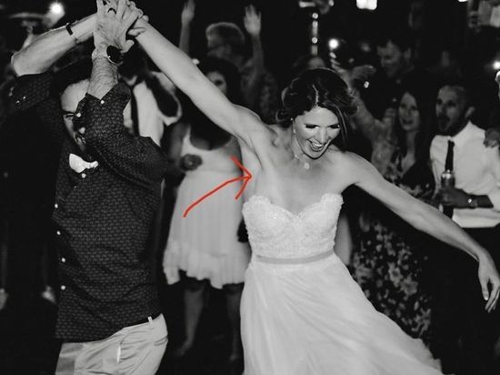 Фото со свадьбы помогло невесте обнаружить рак
