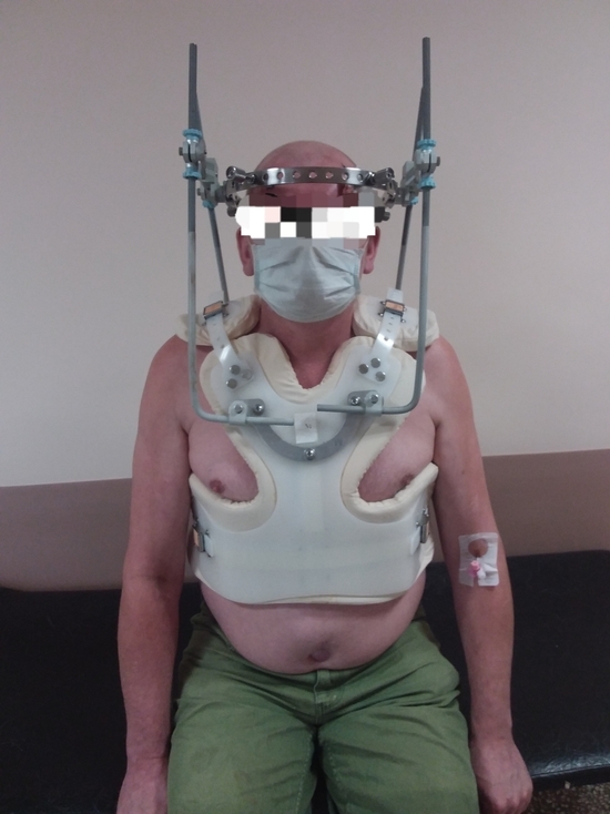 «Обычно с такой травмой не выживают»: красноярские врачи спасли мужчину со сложнейшим переломом шеи