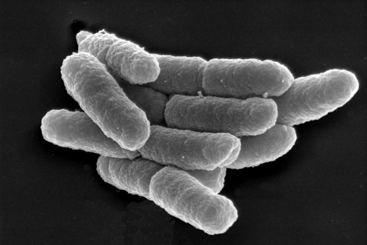 Возбудитель чумы. Yersinia pestis чумная палочка. Чума возбудитель (Yersinia pestis).