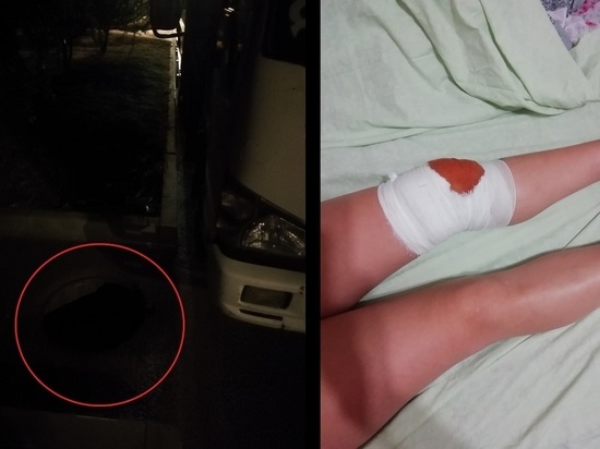 В Краснодаре девушка получила травмы, провалившись в открытый люк