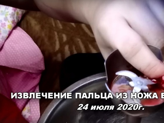 В Новосибирске спасатели достали лезвие блендера из пальца кулинарки