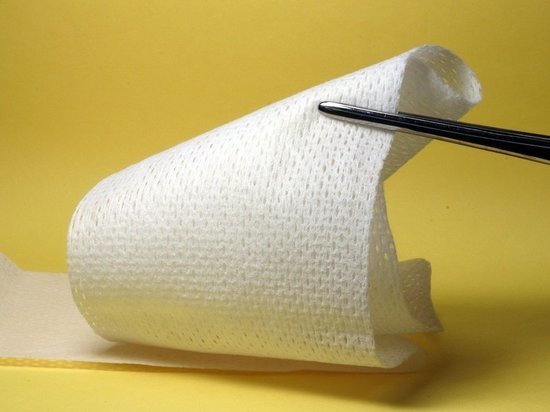 В Петрозаводске собственники многоквартирного дома выплатят компенсацию девочке, получившей травму