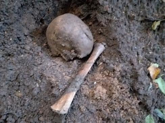 В центре Смоленска на поверхность земли вытолкнуло множество человеческих костей