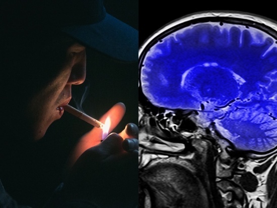Курение оказалось способно спровоцировать кровоизлияние в мозг