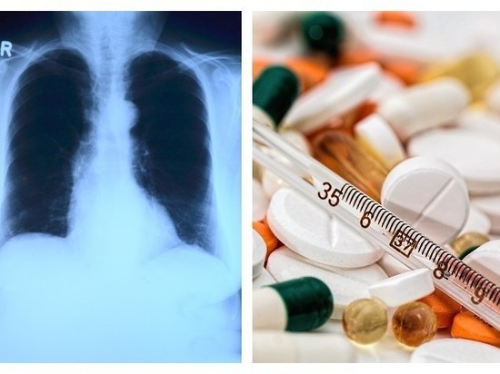 Онколог Левченко рассказал о первых симптомах рака легких