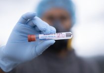 За последние сутки коронавирус выявлен еще у 237 забайкальцев, число заразившихся за время пандемии составило 12 028