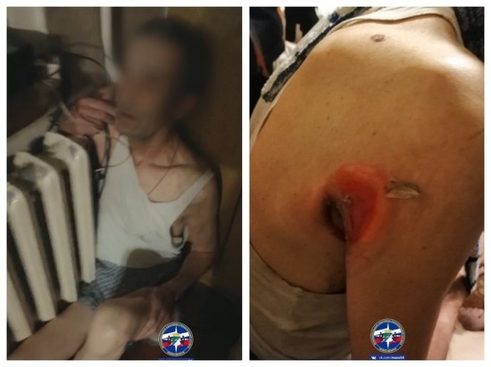 В Новосибирске мужчина во сне застрял в горячей батарее и серьезно пострадал