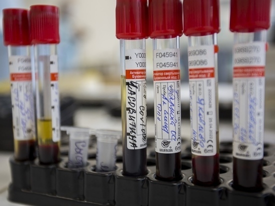 В Роспотребнадзоре сократили срок выполнения теста на коронавирус