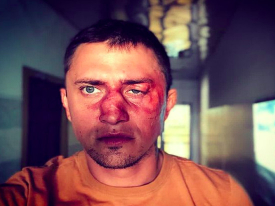 Дело об избиении Павла Прилучного расследует калининградская полиция