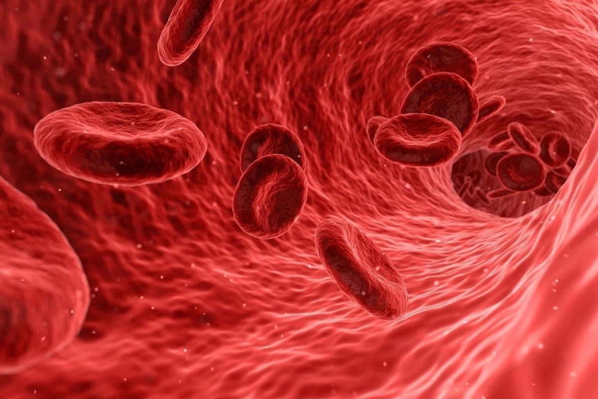 Multiple Myeloma Symptoms: Positive Curability Hope