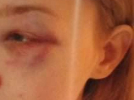 В Челябинске двое парней избили школьницу на глазах у ее мамы