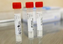 В мире появился первый официально зарегистрированный случай повторного заражения SARS-CoV-2 у пациента, имевшего высокий уровень антител после перенесенной болезни