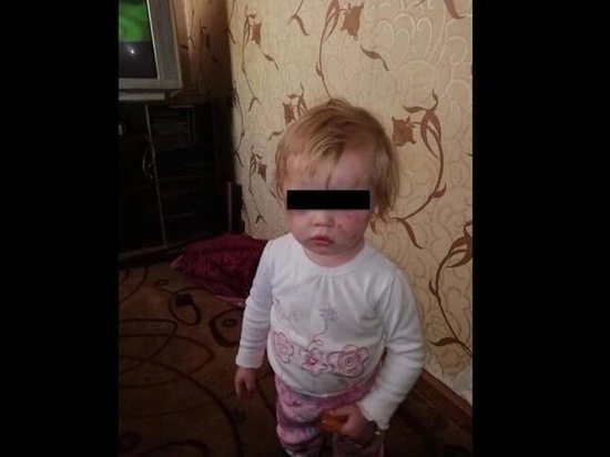 СК завёл дело на мать детей, доставленных с побоями в Рязанскую ОДКБ