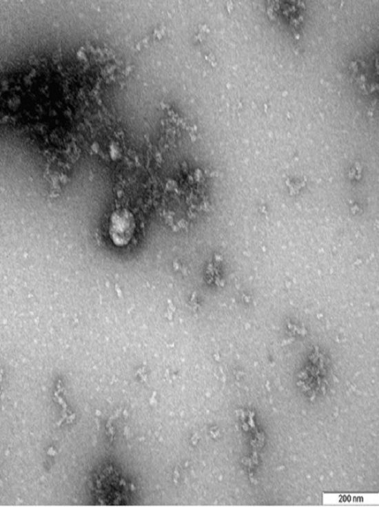 Новосибирские ученые сделали фото «британского» штамма коронавируса