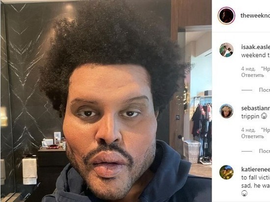 Певец The Weeknd испугал фанатов результатами пластической операции