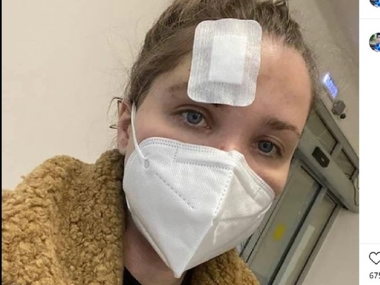 Экс-жена Епифанцева выложила фото изуродованного лица после драки