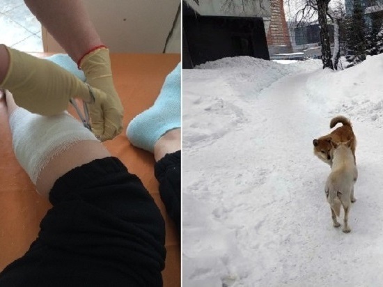 На жительницу Новосибирска напали бездомные собаки в центре города