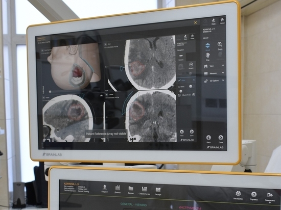 Донецкая клиника получила оборудование для операций на головном мозге