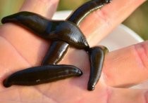 Противопоказаний для лечения пациентов с коронавирусной инфекцией при помощи медицинских пиявок нет