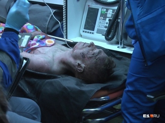 В Екатеринбурге голый мужчина облил себя бензином и поджег