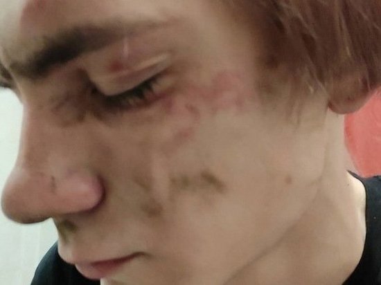  Студента факультета журналистики НГУ избили под Новосибирском
