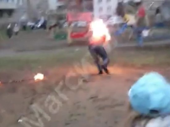 Мужчина, который загорелся во время фаер-шоу в Магнитогорске, не имел отношения к "Библионочи"