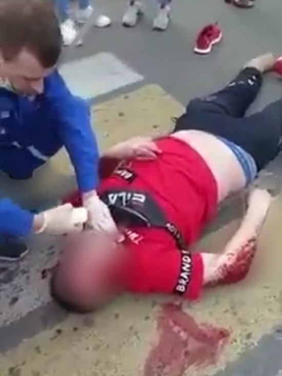 В Челябинске иномарка сбила мужчину на электросамокате