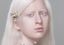 «Волосы в темноте светятся»: альбиносы раскрыли тайны своей жизни