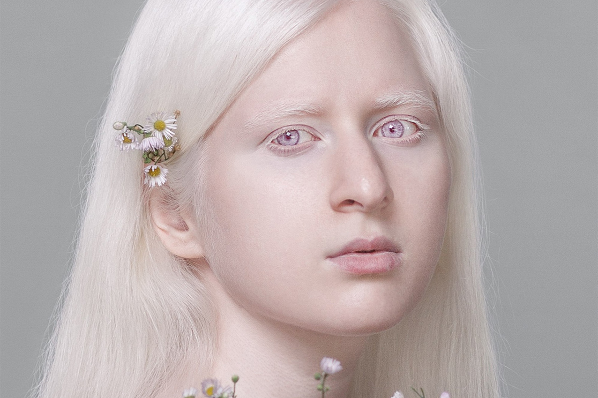 Волосы в темноте светятся»: альбиносы раскрыли тайны своей жизни - МК