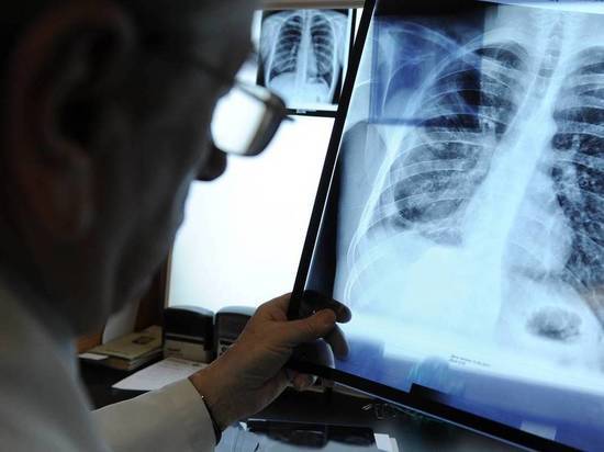 В Хакасии из-за COVID-19 участились случаи пневмонии: развернуто еще 35 коек