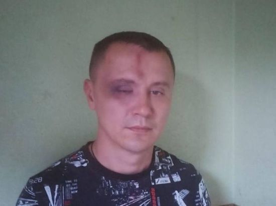 В Новосибирске полиция начала проверку по факту избиения мужчины на улице Ватутина