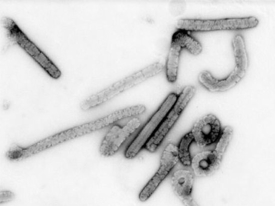 Обнаруженный в Африке вирус Марбург начал убивать: названы симптомы