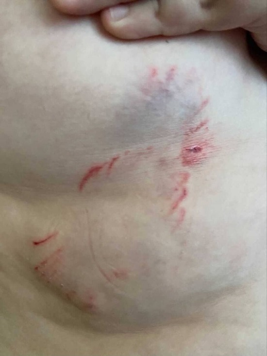 Соцсети: домашняя собака укусила ребенка в Ноябрьске
