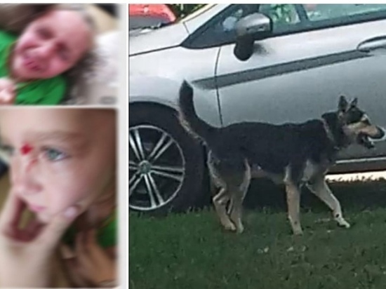 СК проверит информацию о нападении бездомной собаки на ребенка под Рязанью
