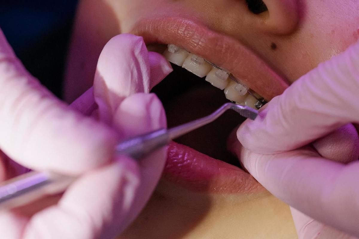 Cuanto cuesta endodoncia