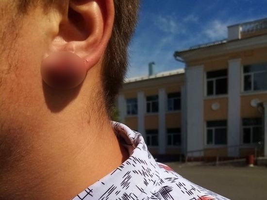 В Курской области директор школы порвал ухо подростку за отказ снять серьгу