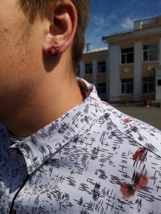 В комитете образования Курской области прокомментировали инцидент с разорванным ухом ученика за отказ снимать сережку