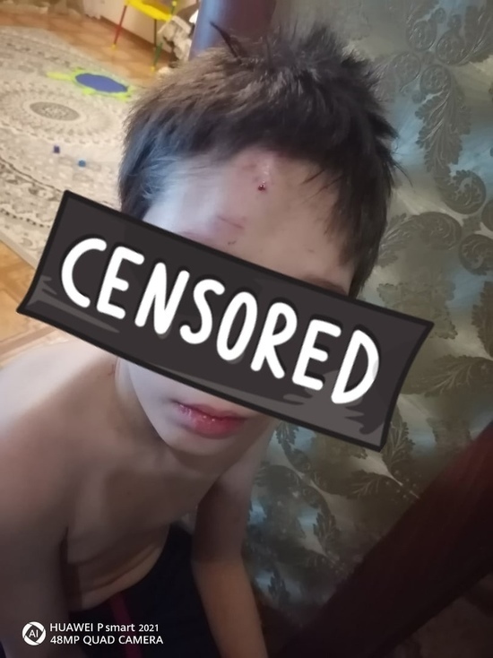 Соцсети: подростки избили и ограбили мальчика-инвалида в Надыме
