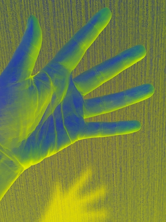 Сосед схватил палку и перебил смолянину руки