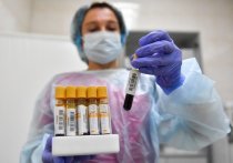 В правительстве Ростовской области намерены изучить практику выдачи QR-кодов жителям с высокими антителами к коронавирусу, независимо от того, болели они «официально» или нет