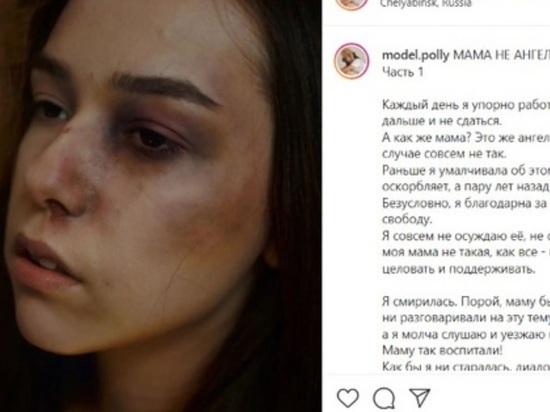 Глава СКР заинтресовался историей челябинской блогерши, ставшей жертвой домашнего насилия