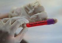 Посланник ВОЗ по COVID-19 Дэвид Набарро предупреждает о «беспрецедентном» распространении варианта коронавируса «Омикрон» после того, как Великобритания зафиксировала самый высокий уровень ежедневных случаев заболевания с момента начала пандемии