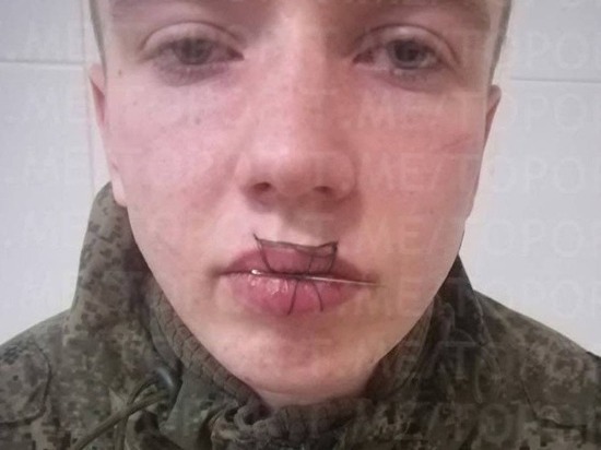 В Чебаркуле солдат зашил себе рот из-за того, что оскорбил свою девушку по телефону
