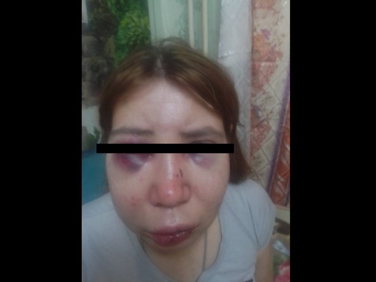Полиция Томской области разбирается с кровавой женской дракой в Мало-Жирово