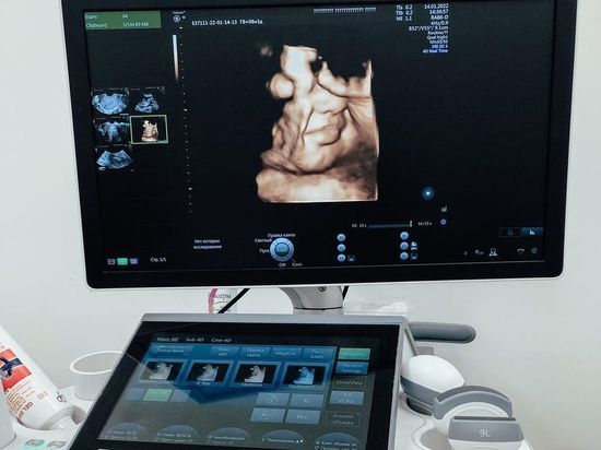 Беременные псковички теперь могут увидеть ребенка в 4D