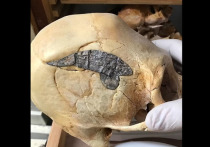 Металлическая пластина, имплантированная 2000 лет назад в голову перуанского воина, считается первой в мире операцией на черепе