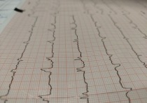 Врач-кардиолог Анна Кореневич на своем YouTube-канале назвала три предвестника инфаркта, которые не стоит игнорировать