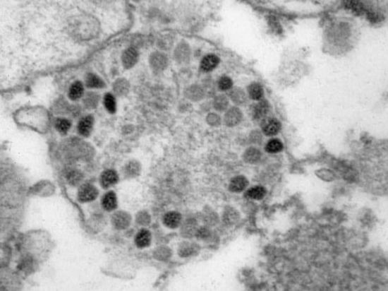 Первые случаи омикрон-штамма коронавируса выявили в Новосибирской области