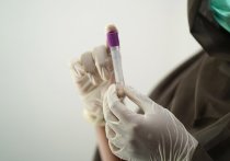 Может ли удаление крошечных кровяных сгустков изгнать «длительный COVID»? Возможно, опыт 48-летнего британского респираторного врача, который не мог работать в течение года после того, как стал страдать затяжными симптомами коронавирусного заболевания, поможет найти ключ к загадке таинственной болезни