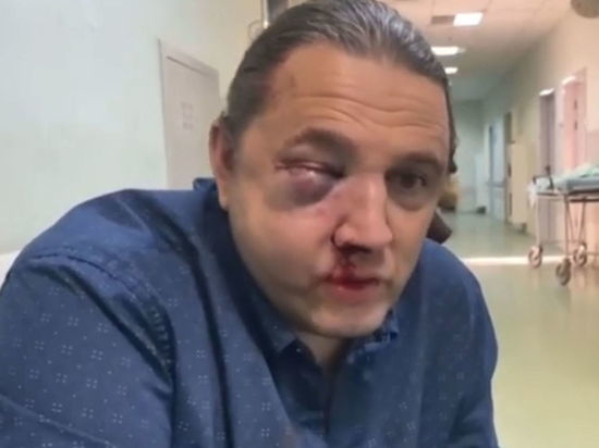 Избитый экс-депутат Шингаркин рассказал о нападении: "Выслеживали неделю"